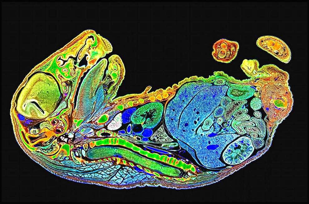 This incredibly fascinating cross-section of a mouse fetus.