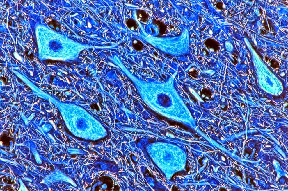 The infinite complexity of human neurons found in the medulla oblongata.
