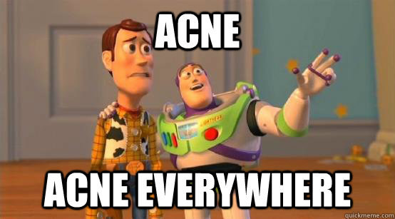 Acne is a natural thing in life that we all have to deal with.