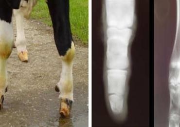 Genetic syndactyly that specifically affects the distal limb of cattle is also referred to as mulefoot. Syndactyly is when the two digits of the hoof fail to divide or become fused. This genetic disorder is an autosomal recessive trait and is expressed with incomplete penetrance. This mutation affects the LRP4 gene which has been proven to play a significant role in digit differentiation in multiple mammalian species. The LRP4 gene is believed to be a negative regulator of the Wnt-beta-catenin pathway. Unfortunately, there is still a lot of research to be done on this pathway but the general idea is that a reduction in Wnt affects the production of other hormones such as SHH, FGF8, and BMP. The concentrations of these hormones and others such as RA, IHH, and the expression of Hox genes all play a role in cell apoptosis and the formation of a complete limb bud. Source: A. Duchesne, M. Gautier, S. Chadi, C. Grohs, S. Floriot, Y. Gallard, G. Caste, A. Ducos, A. Eggen, Identification of a doublet missense substitution in the bovine LRP4 gene as a candidate causal mutation for syndactyly in Holstein cattle, Genomics, Volume 88, Issue 5, November 2006, Pages 610-621, ISSN 0888-7543Drogemuller, Cord, and Tosso Leeb. "Congenital Syndactyly in Cattle: Four Novel Mutations in the Low Density Lipoprotein Receptor-related Protein 4 Gene (LRP4)." BioMed Central. N.p., 23 Feb. 2007. Web. 16 Nov. 2016.ANSC 452 Notes: "Limb Development"