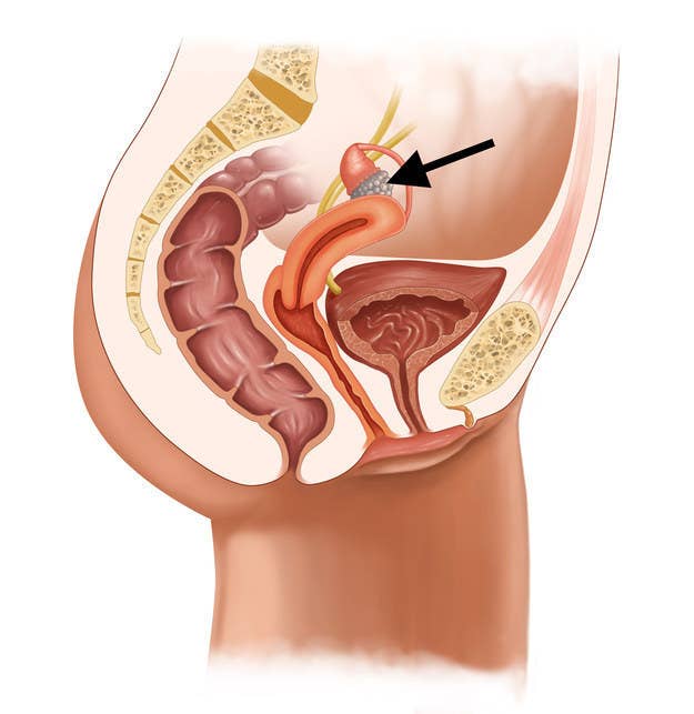 Schaffst Du Dieses Schwierige Quiz Uber Die Weibliche Anatomie