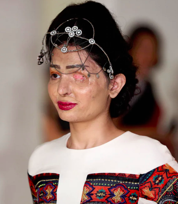 Reshma Qureshi, the woman who survived an acid attack and went on to walk in a show at New York Fashion Week.