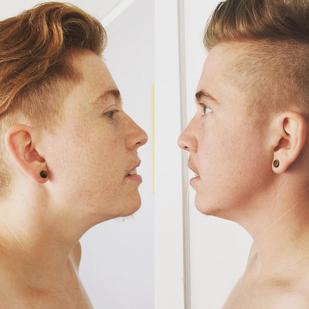 The third stage involves the hope that the individual can avoid the desire to change. They question if their decision to transition was right. They negotiate their need to change in exchange for a former lifestyle. They scroll through old photos and question if it is possible to return to how things used to be and possibly be happy?