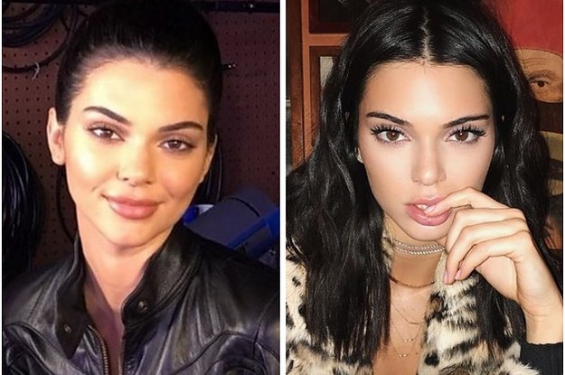 Kendall Jenner Just Shut Down Those Lip Filler Rumours