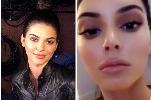 Kendall Jenner Just Shut Down Those Lip Filler Rumours