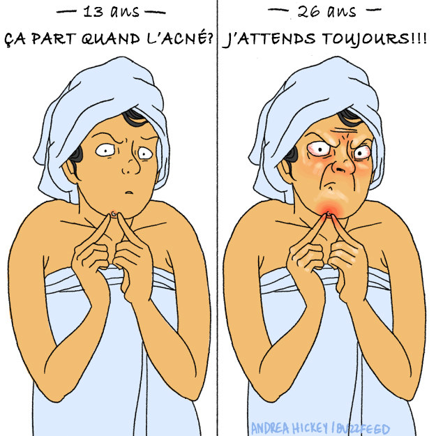 Votre peau s'est probablement améliorée avec le temps, mais les boutons ne sont jamais complètement partis.