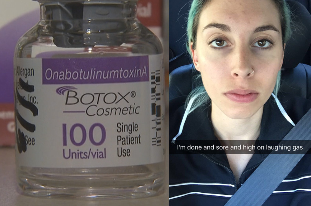 I Got Botox In My Vagina And It Changed My Life