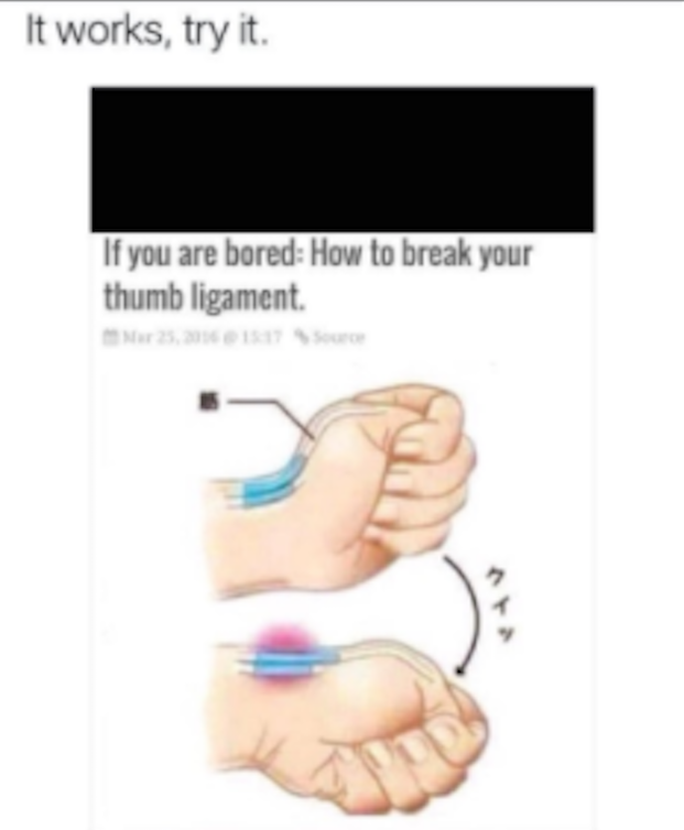 break your thumb easily