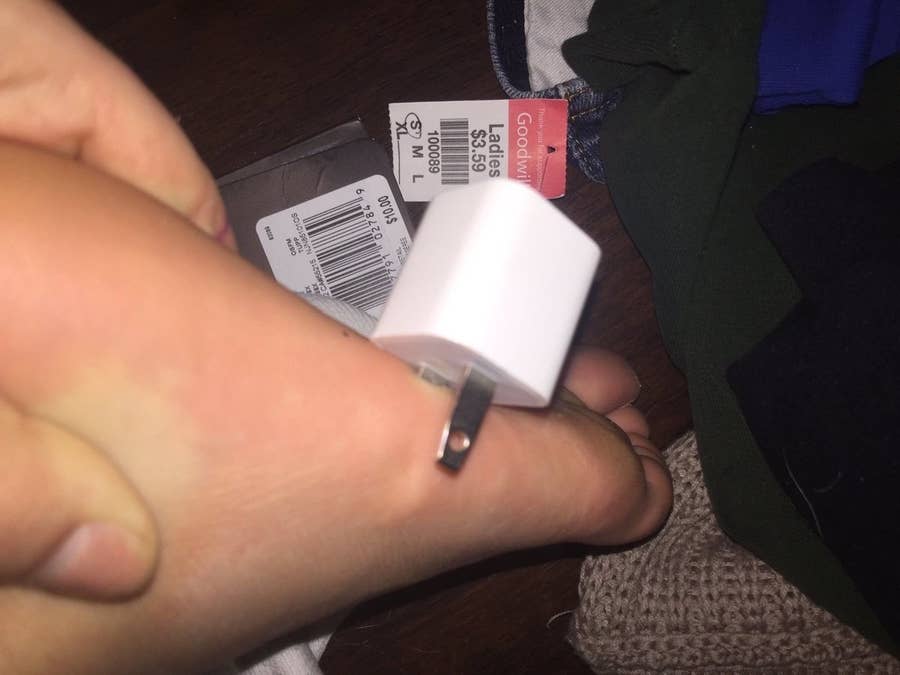 充電器のプラグが足に刺さった 痛そうすぎる瞬間の写真
