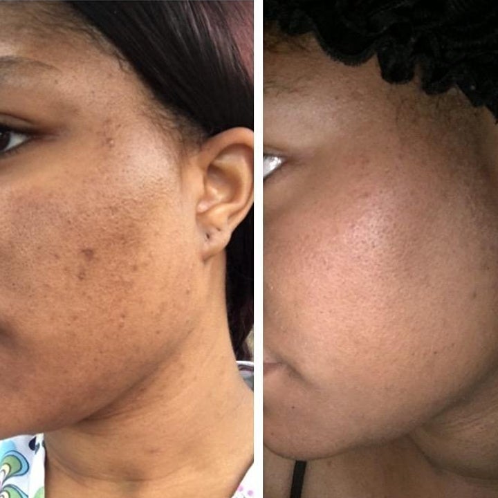 27 Skin Care Products That Actually Do What They Say They Will