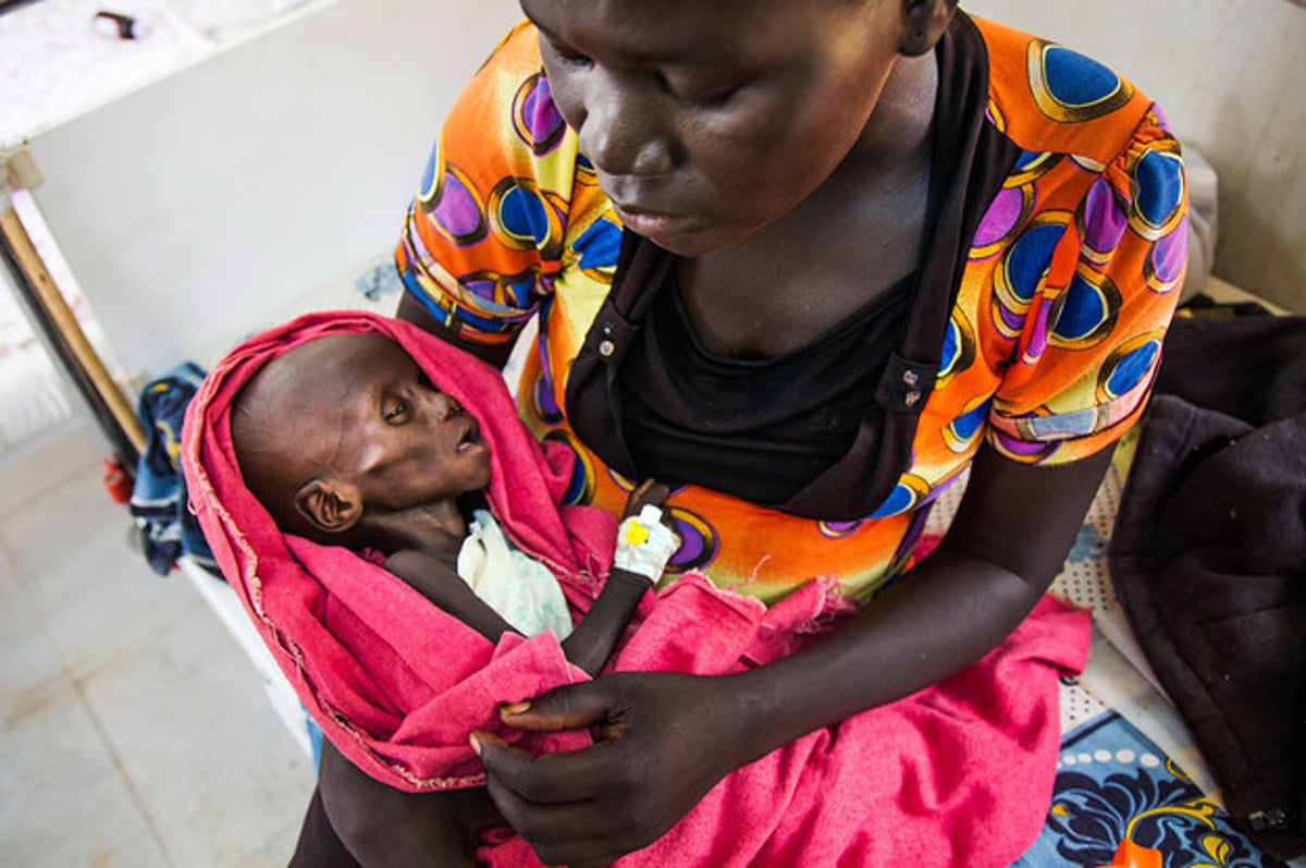 自衛隊が派遣された南スーダン そこには飢餓で死んでいく赤ちゃんがいる