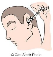 Earwax!