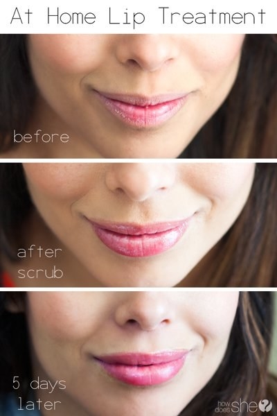 Exfoliate your lips once a week with an easy DIY blend of olive oil and sugar.