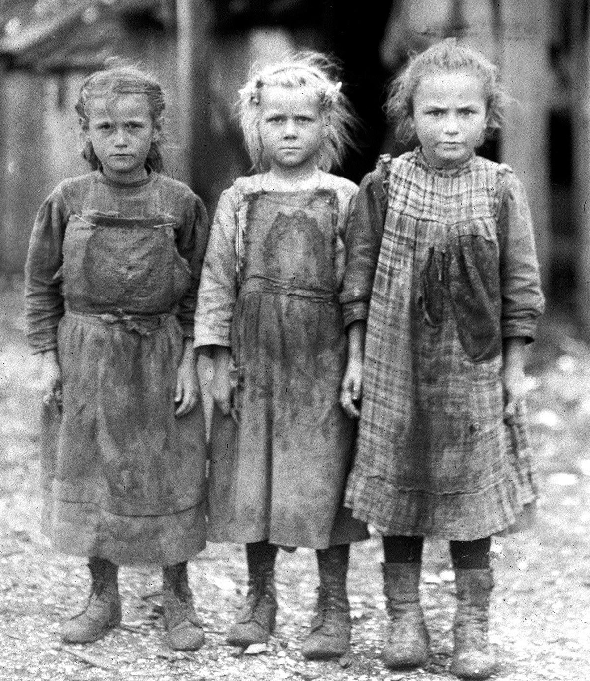 progressive era child labor injuries