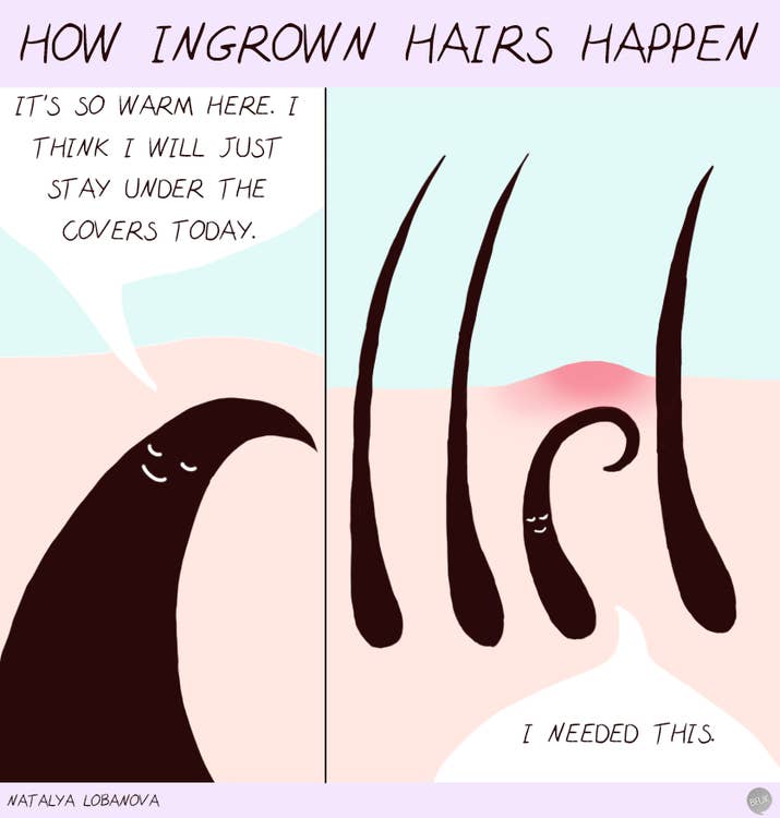 Though finally getting to dig these bad boys out is definitely the best part of hair removal.