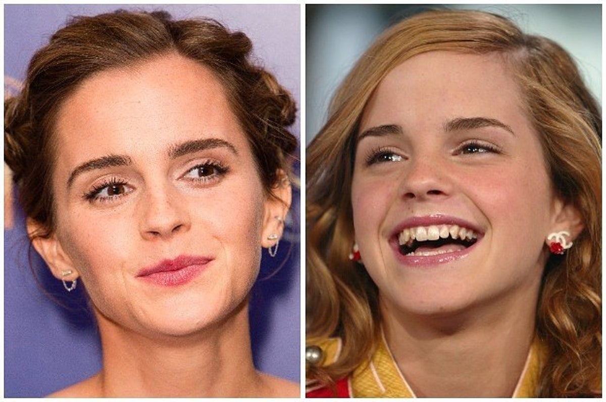 Emma Watson Porn Facial - 23 Times Emma Watson Was Relatable AF