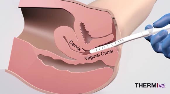 Here S What Gynecologists Think Of 10 Popular Vagina Trends