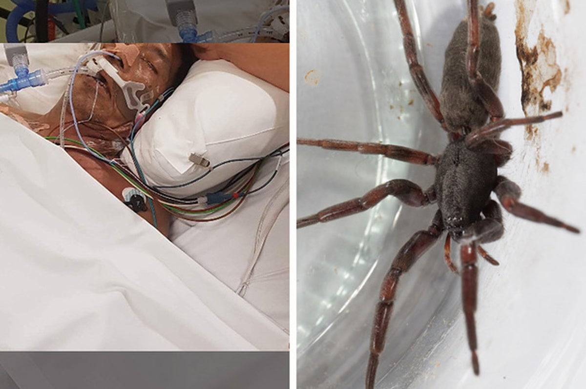 giant australian spider bites