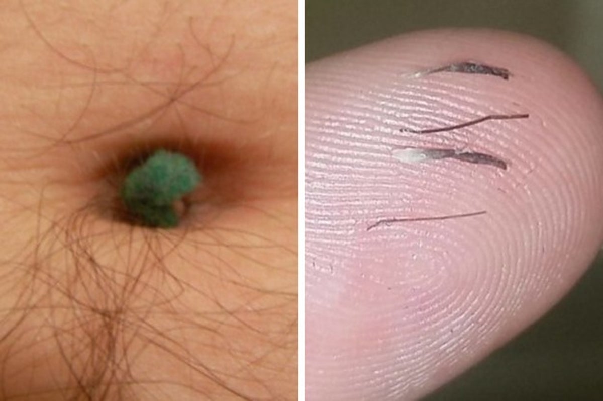 18 Of The Most Grossly Satisfying Things You Can Do To Your Body