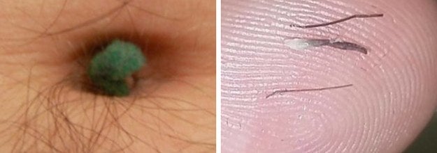 18 Of The Most Grossly Satisfying Things You Can Do To Your Body
