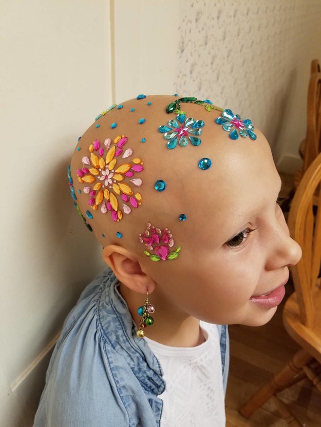 In a matter of just 20 days, all her hair was gone. But that didn't stop the stylish 7-year-old from celebrating "crazy hair day" at school.