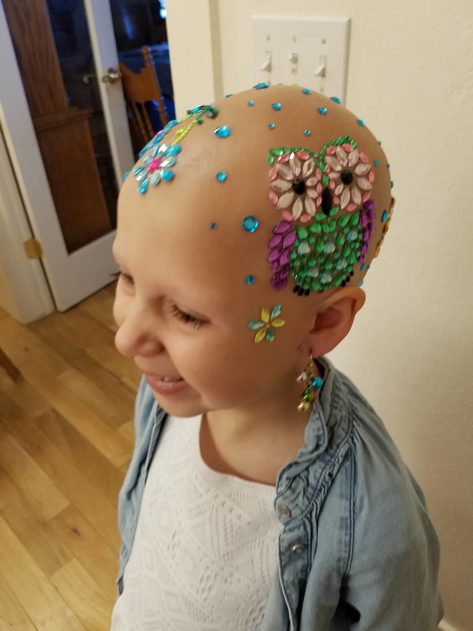 A 7-Year-Old Who Lost All Her Hair Celebrated Crazy Hair 