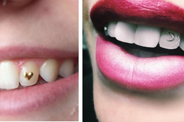tooth gems come buzzfeed