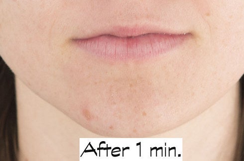 How Can I Make My Lips Permanently Bigger Without Surgery