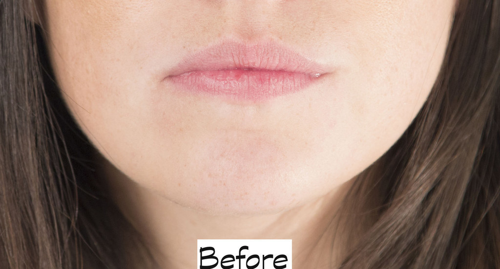 victoria's secret lip plumper before and after