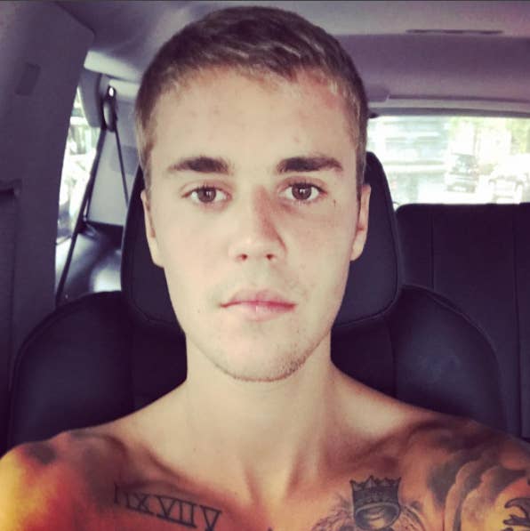 Justin Bieber Just Revealed Something About His Health And I Feel So Bad  For Him