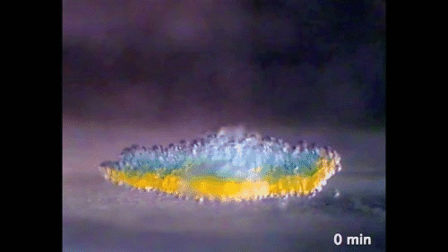 By allowing neural stem-cell tissue to self-organize, researchers have been able to get 3D brain tissue to grow outside the body. This could be tremendously useful for learning more about how the brain works, studying and observing brain diseases like Parkinson's, and better understanding how to treat traumatic brain injuries and degenerative disorders.