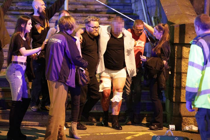 A man with injuries is helped outside the Manchester Arena Monday night.