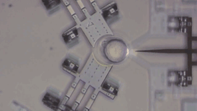By the time many medical problems become apparent, they may be past the point of easy treatment. To combat this problem, tiny nanosensors are being put inside people's bodies in order to detect problematic cell growth. Artificial hip implants are a good example of this, where nanosensors are put on the implant in order to detect potential infection and harmful scar-tissue buildup before they're too far along. Without these nanosensors, patients tend only to notice infection when it's so far along that the hip implant needs to be entirely removed and replaced. In the future, scientists hope to use similar nanotechnologies not only for detection but also for maneuvering inside of cells to treat disease.