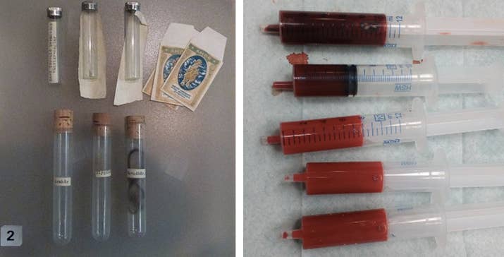 En 1932 una trabajadora sexual fue hallada muerta en Estocolmo. Llevaba tres días sin vida, tenía el cráneo machucado, signos de actividad sexual y se encontró un cacillo junto a la cama. Su sangre se drenó casi por completo y se cree que el asesino desconocido utilizó el cacillo como utensilio para bebérsela. ¡Qué mierda!—a4cf