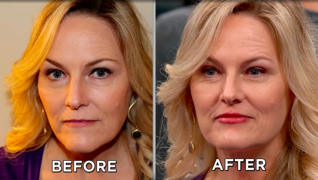 Here's a before and after from a woman who tried it on an episode of The Doctors, and the difference was REAL! We were excited to give it a go.