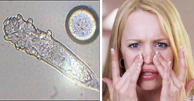 There are little bugs that live on your face and eat the dead skin off of it.