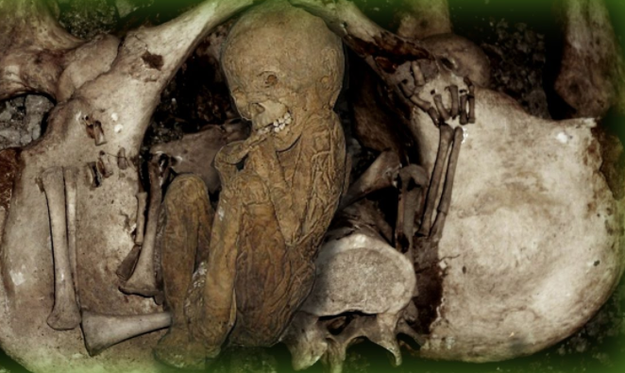 In rare instances, dead women can give birth.