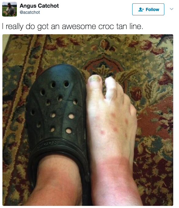 croc foot