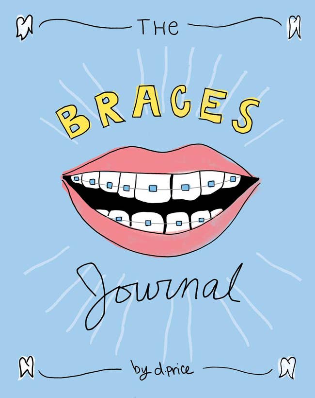 17 Things That Ll Make Having Braces So Much Better