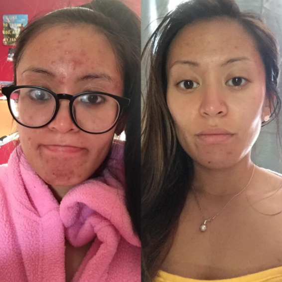 23 Face Masks Under $10 You'll Want To Try Right Now