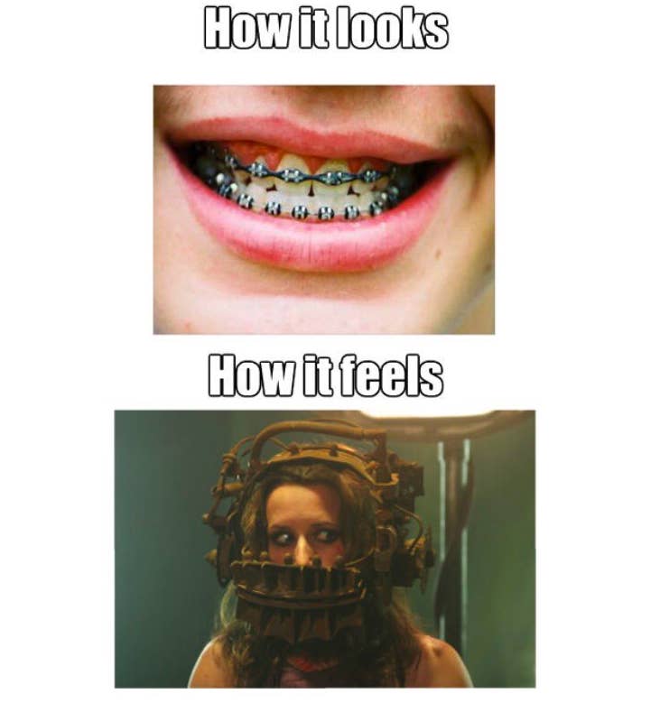 23 Pictures That Will Send Chills Down Your Spine If You Had Braces Quiz if you are having trouble picking the right color for your braces, take this quiz. 23 pictures that will send chills down