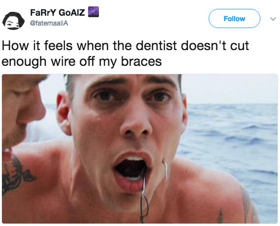 23 Pictures That Will Send Chills Down Your Spine If You Had Braces