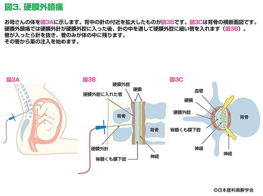 そもそも お産はどれくらい 痛い 医師に聞く 痛みの正体