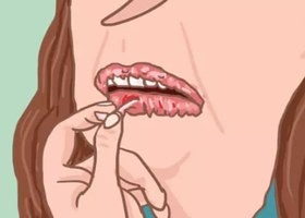 Quitar los pedazos de piel seca de tus labios y dejar los restos.