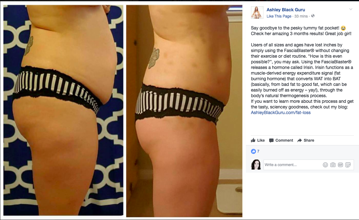 Women Say A Popular New Device To “Get Rid Of Cellulite” Left Them Injured