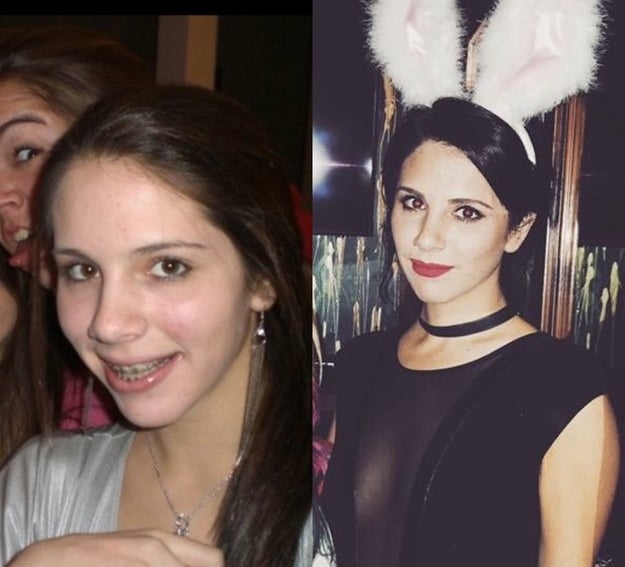 Two side-by-side images of the same woman; one with braces, the other in a choker and furry bunny ears headband