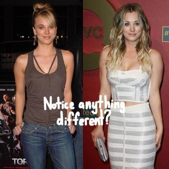 No surprise to Big Bang Theory fans, Kaley had her boob job at age 18. She told an interviewer that she “always felt ill-proportioned” and that the “implants made her feel more confident”