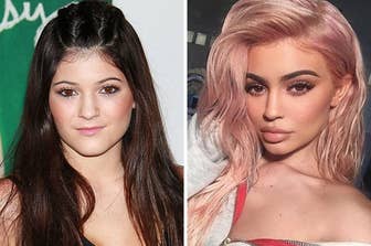 Heres Everything You Need To Know About Kylie Jenners Lips
