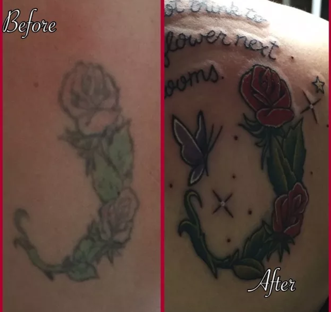 Before & After Images of Laser Tattoo Removal | Way Gone Laser