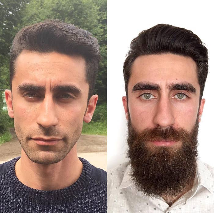 17 Before-And-After Pics That Prove You Look Like A Different Person With A Beard